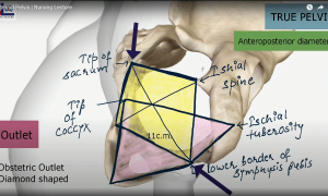 True Pelvis