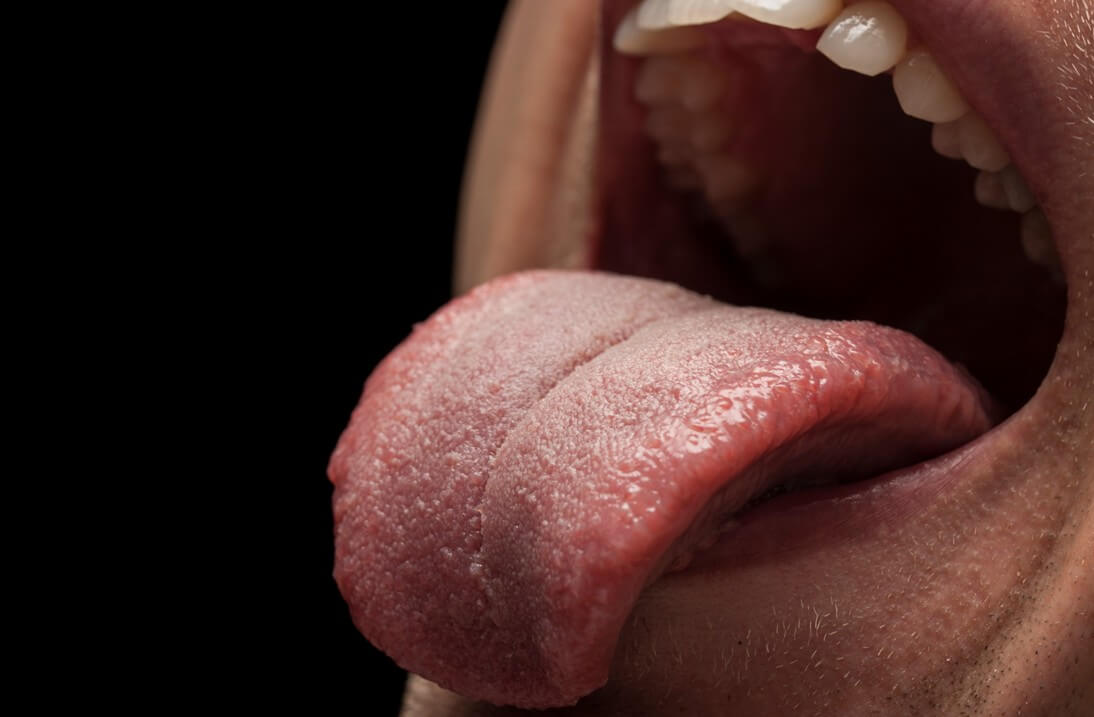 Tongue
