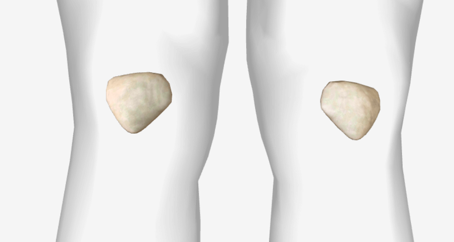 patella