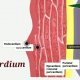 Heart-wall-and-its-coverings